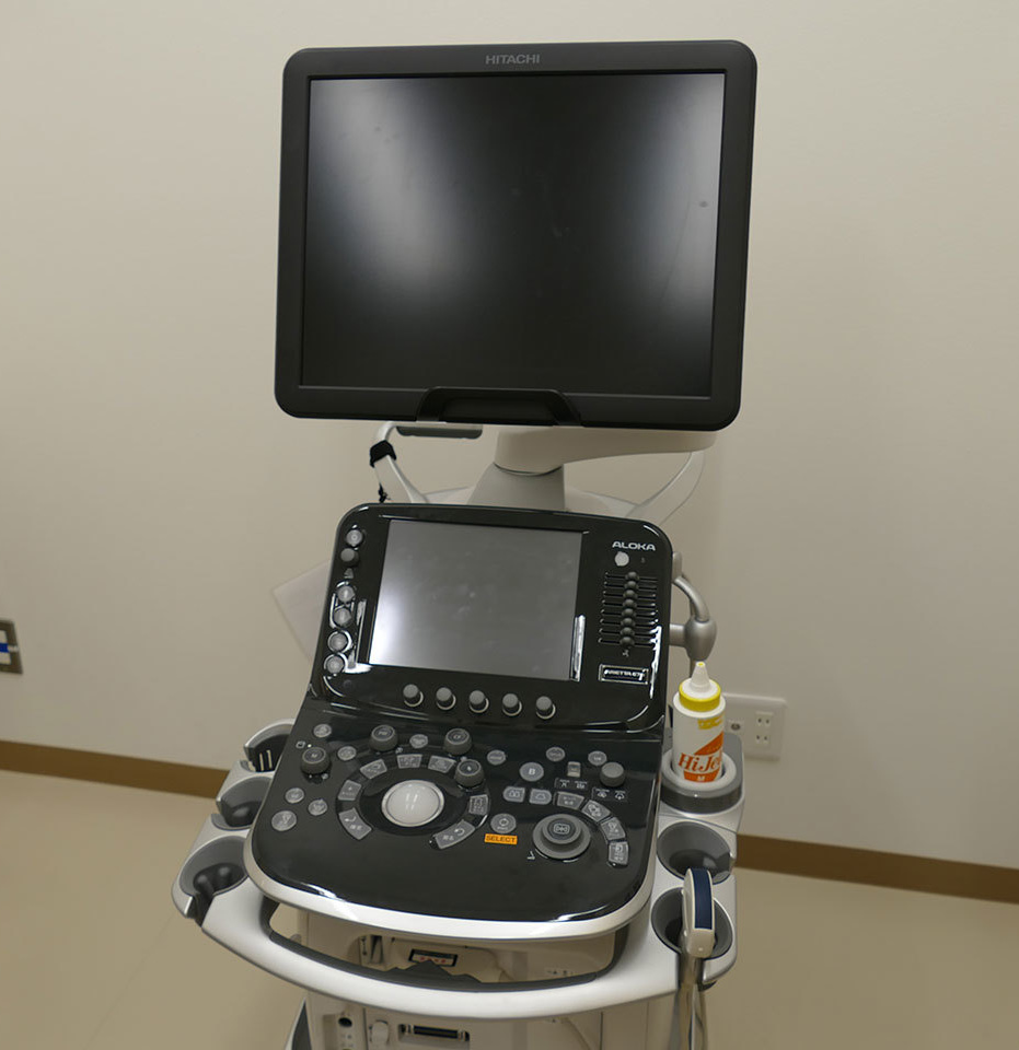 超音波診断装置